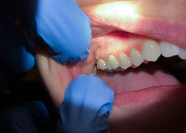 Best Emergency Dental Surgery in Mar Mac, NC