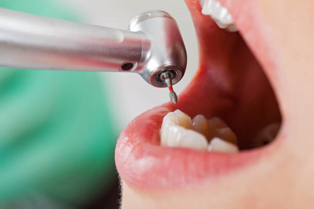 Best Emergency Broken Tooth Repair in Mar Mac, NC